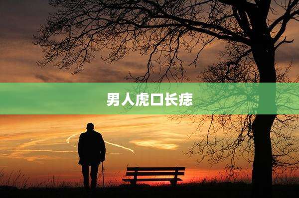 男人虎口长痣