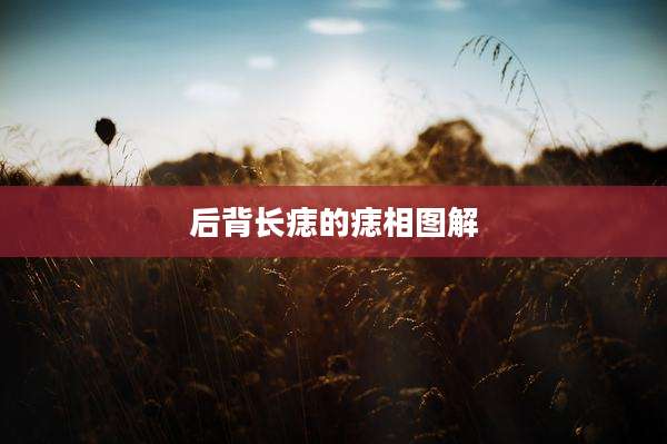 后背长痣的痣相图解